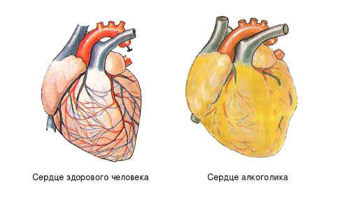 Инфографика сердце алкоголика